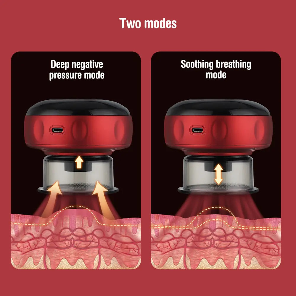 Vacuum Cupping Massage